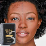 African Black Soap Shea Butter Cleansing Soap for Face Body