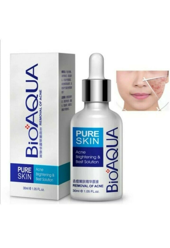 BIOAQUA acne treatment face scar removal spots whitening moisturizing Oil 30ml
